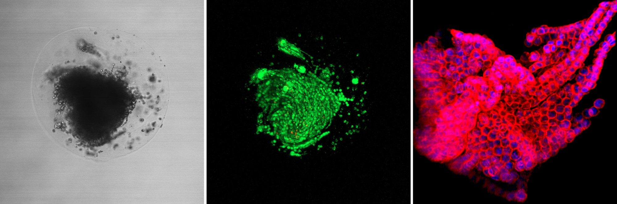 水凝胶微淋巴结“免疫训练营”