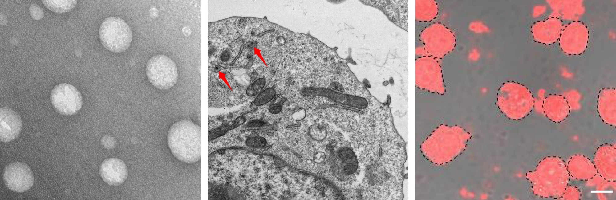 僵尸巨噬细胞封装响应型纳米颗粒