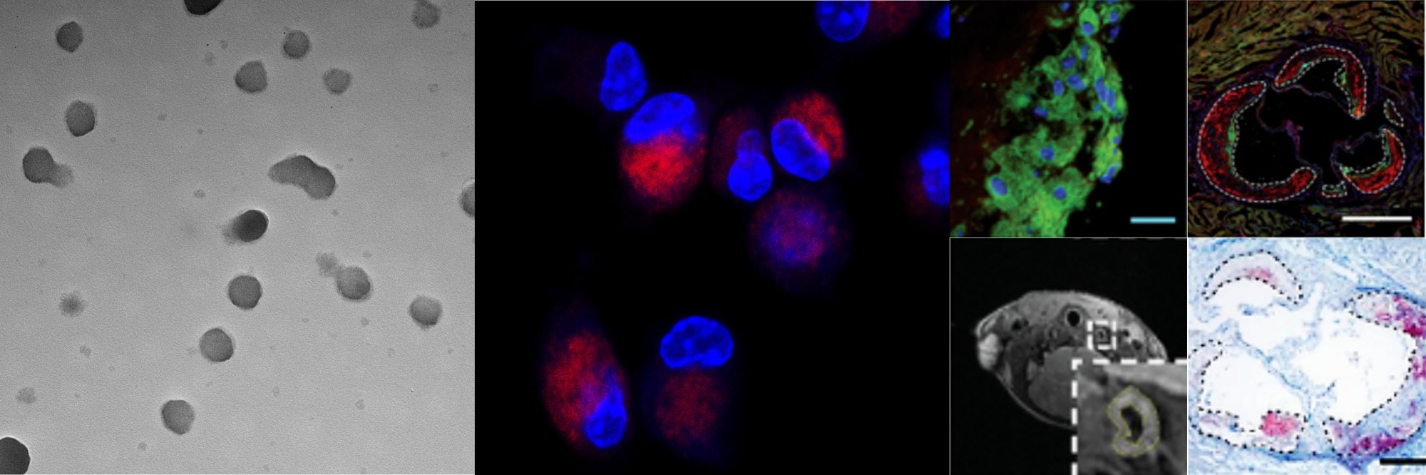 模拟吞噬凋亡细胞的纳米穿梭机